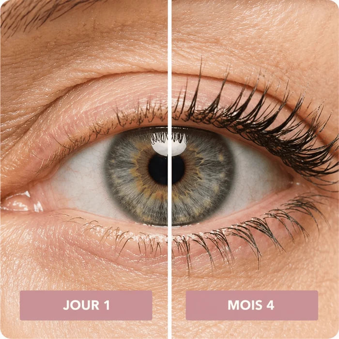 Cils au jour 1 et au mois 4