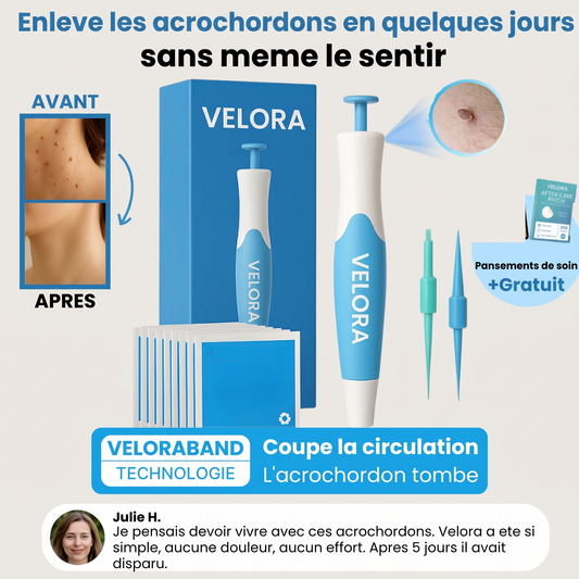 Velora : l'anneau coupe la circulation, l'acrochordon tombe